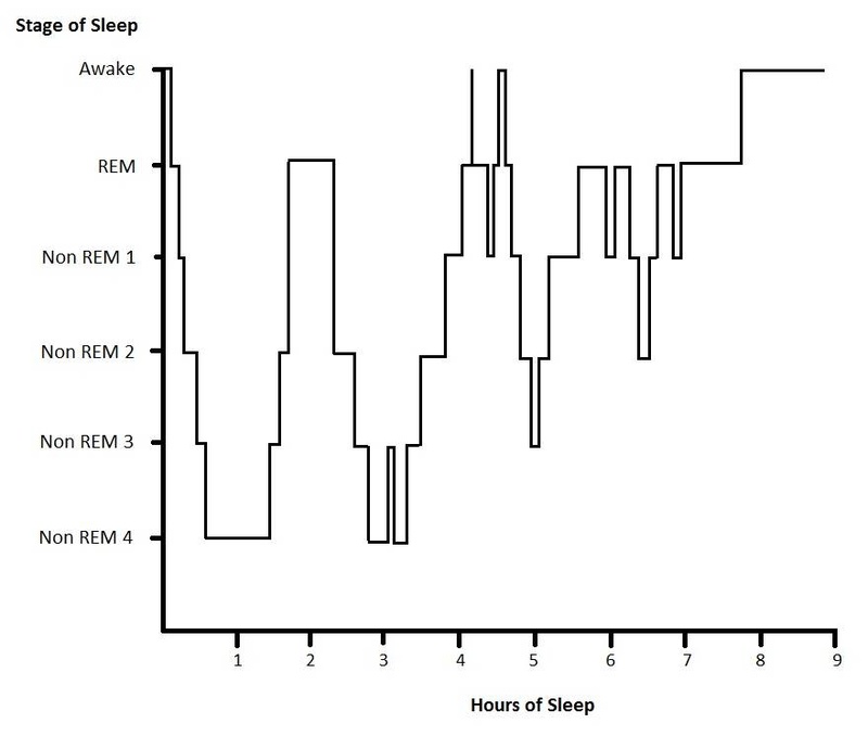 Hypnogram of sleep cycles