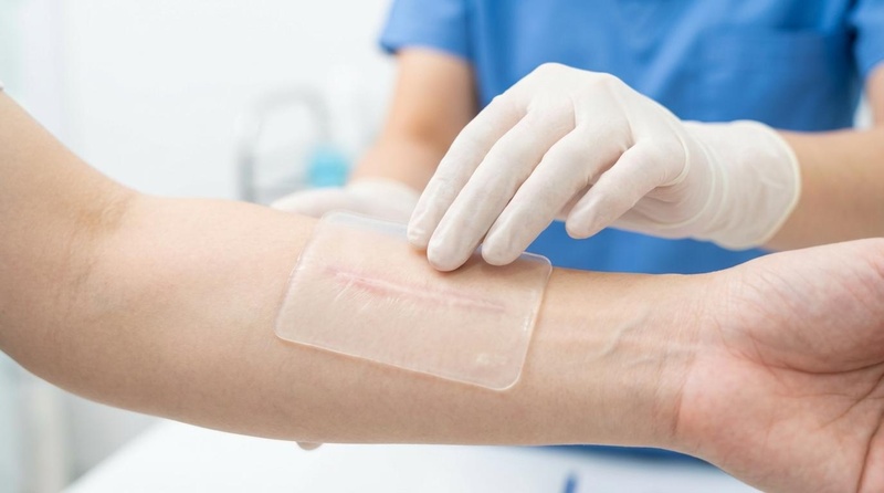 Silicone Sheet Application